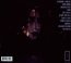 Abyss - Chelsea Wolfe - bigger Abyss - Chelsea Wolfe