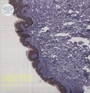 Shedding Skin - Ghostpoet
