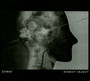 Direct Inject - Zombi